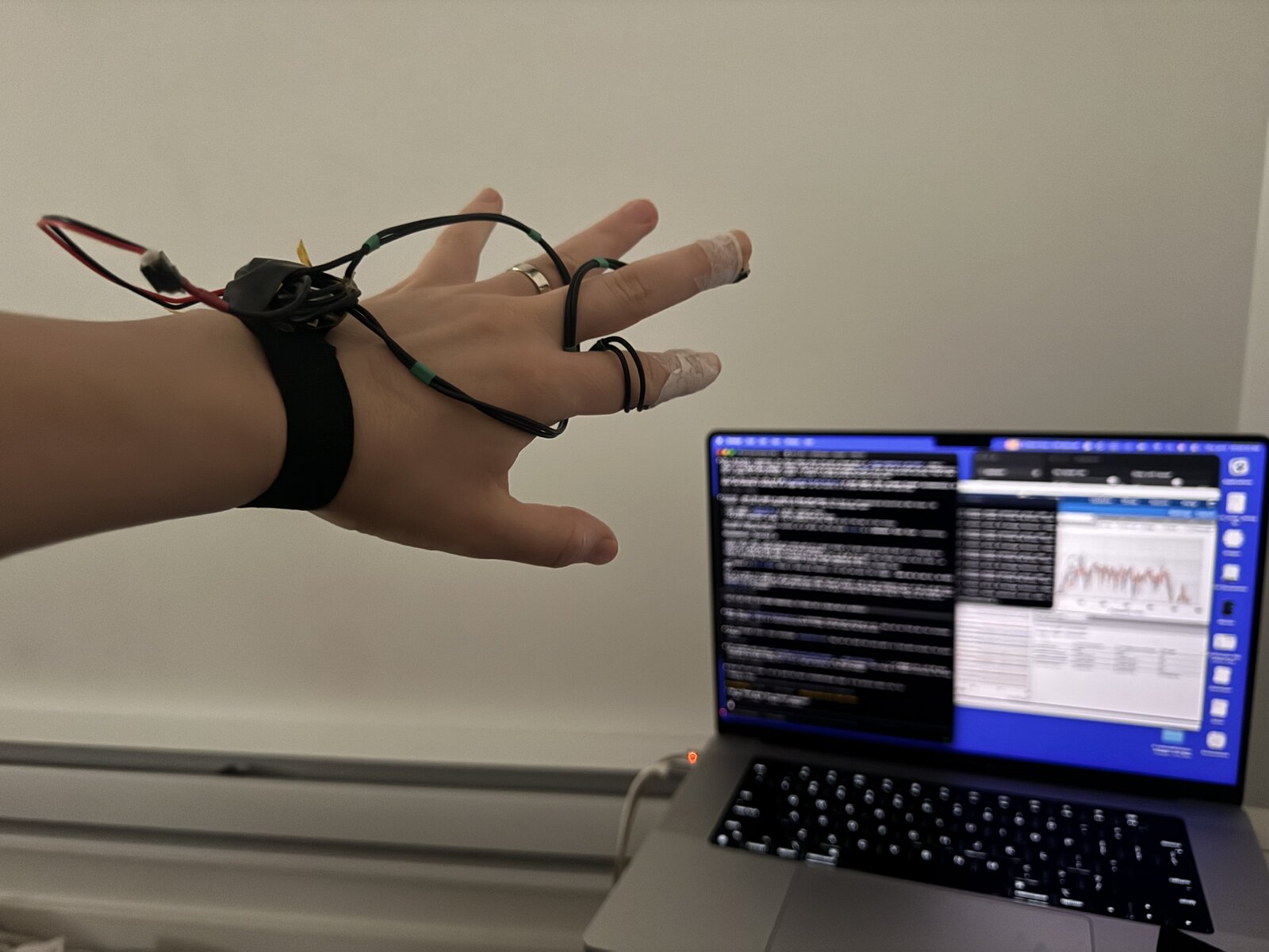 The sleep-data wearable — sensors on my hand with the live data on the laptop behind